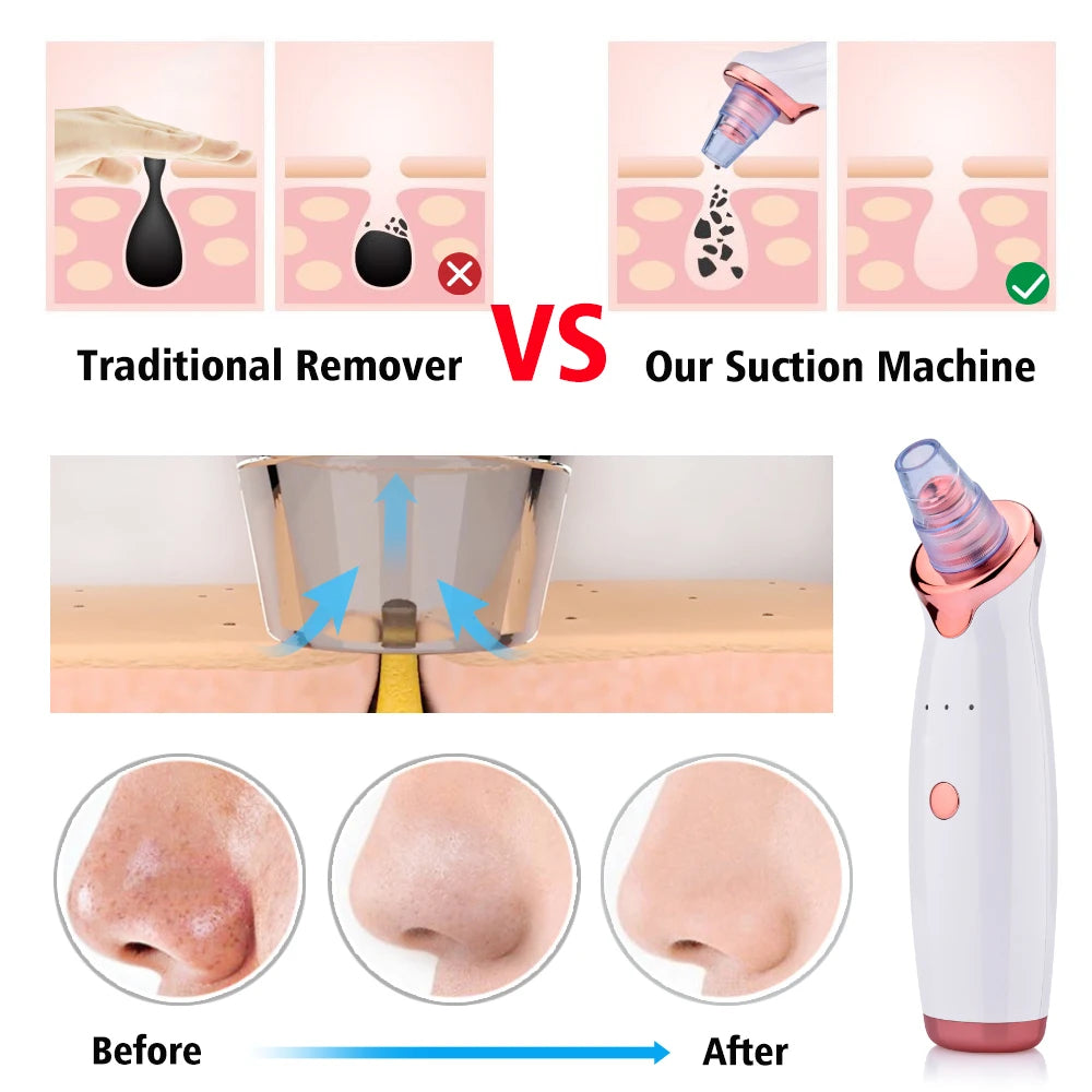 Xrcleaner